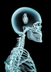 X-ray grenade / 3D render of x-ray with grenade inside head