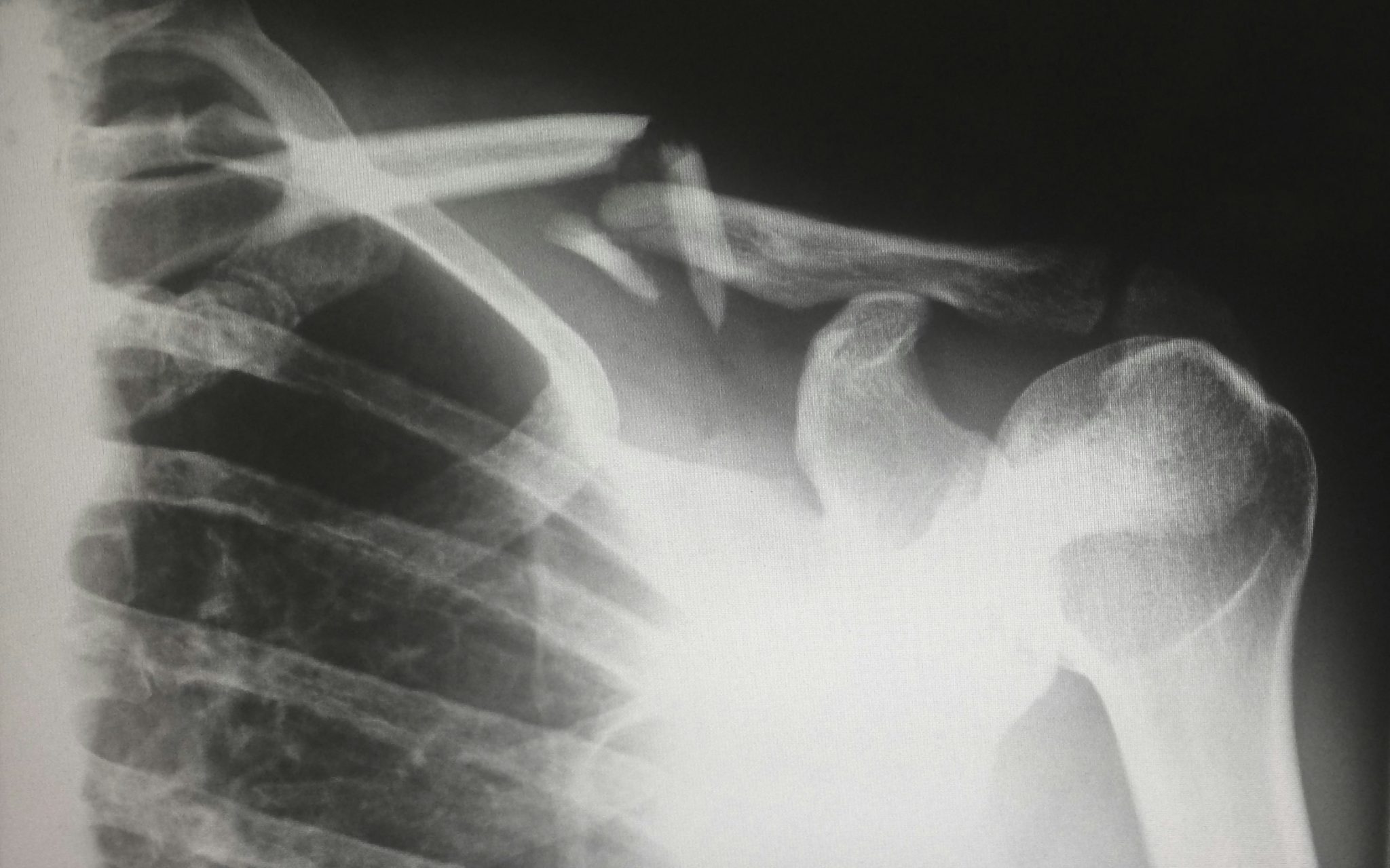 Understanding Your Legal Options After a Life-Changing Accident
